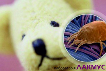 Алергія на пилових кліщів фото